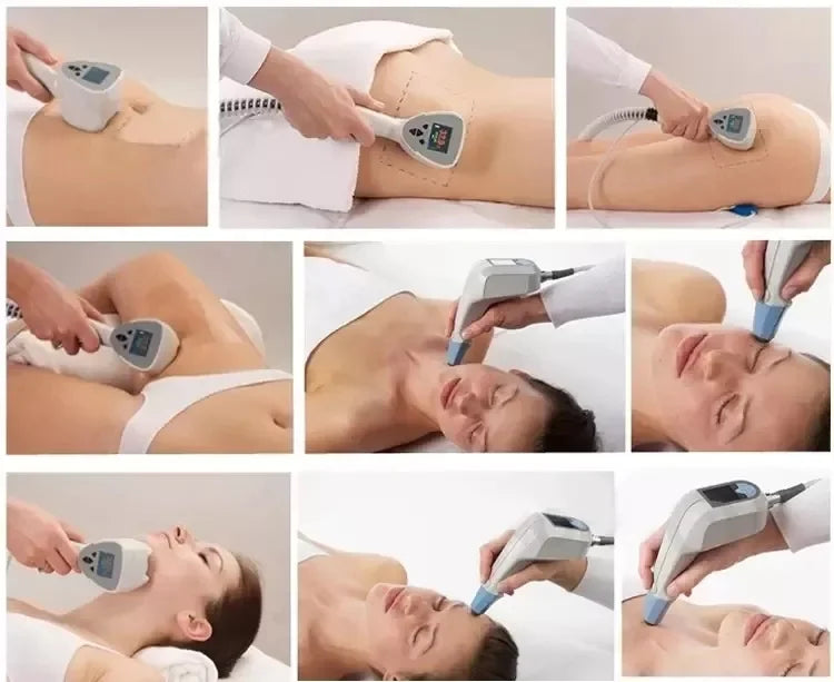 2026 The Latest Model Newly Upgraded RF Skin Firming Machine Degreasing Shrinking Pores Wrinkle Removal No Damage