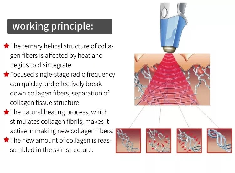 2026 The Latest Model Newly Upgraded RF Skin Firming Machine Degreasing Shrinking Pores Wrinkle Removal No Damage