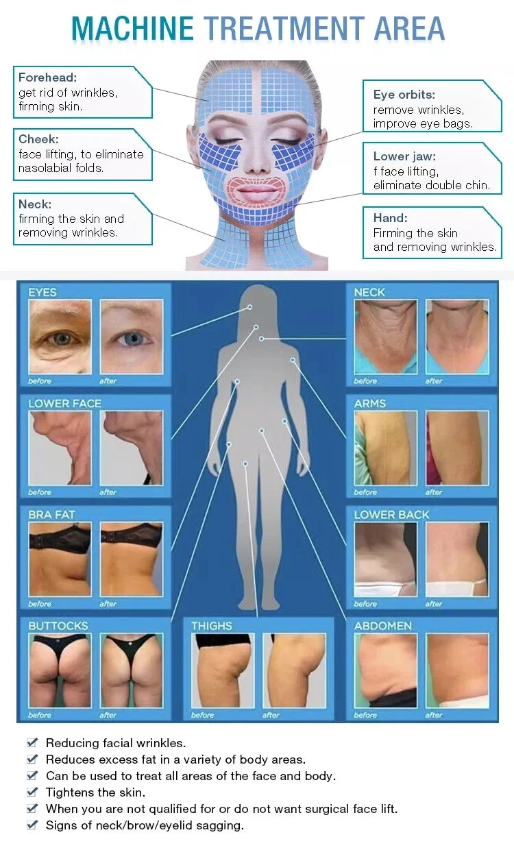 2026 The Latest Model Newly Upgraded RF Skin Firming Machine Degreasing Shrinking Pores Wrinkle Removal No Damage