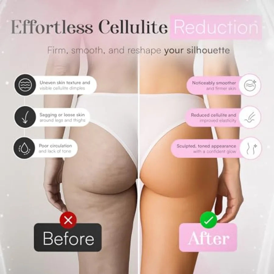 3-in-1 Body Sculpting Machine Thermoslim Cellulite Massager with Cupping and Red Light Therapy for Belly Skin Back Waist Legs a